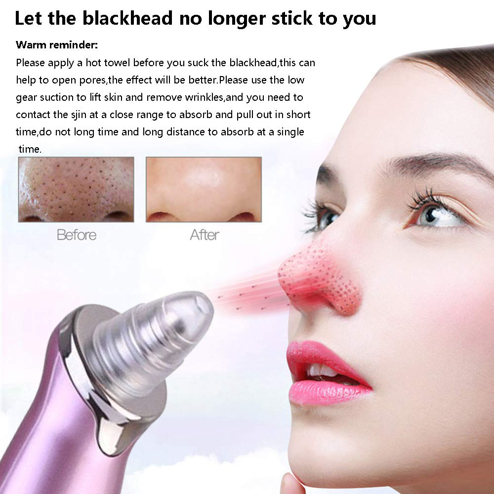 Electric Blackhead Remover Pore Vacuum